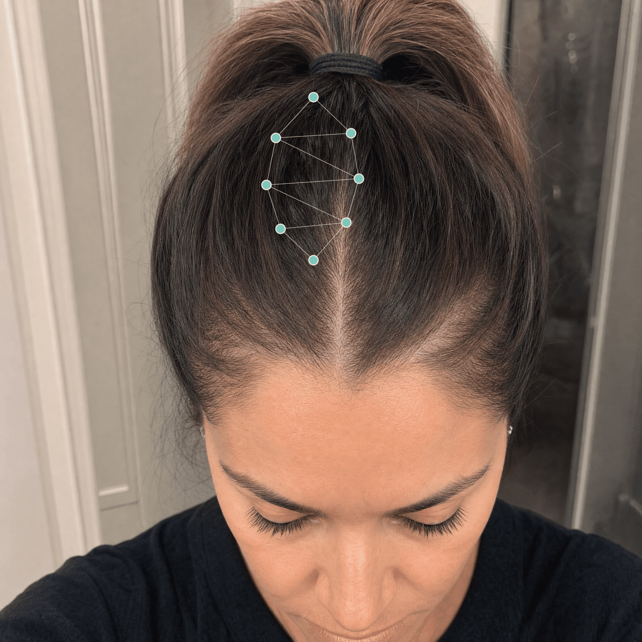 Sarah K. after treatment