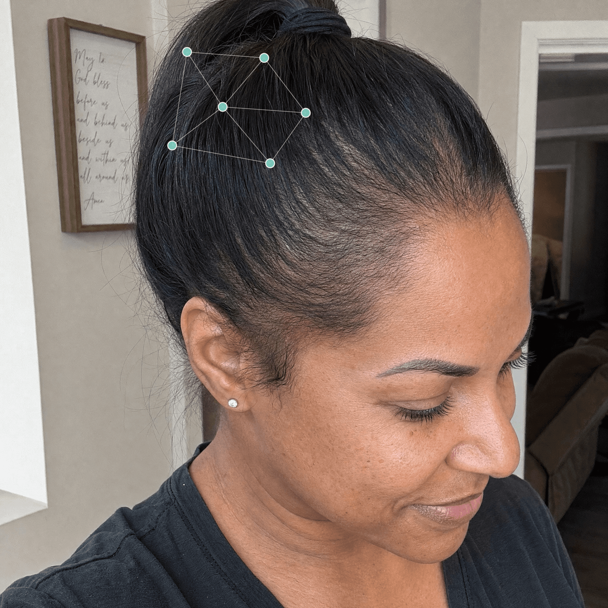 Michelle R. after treatment