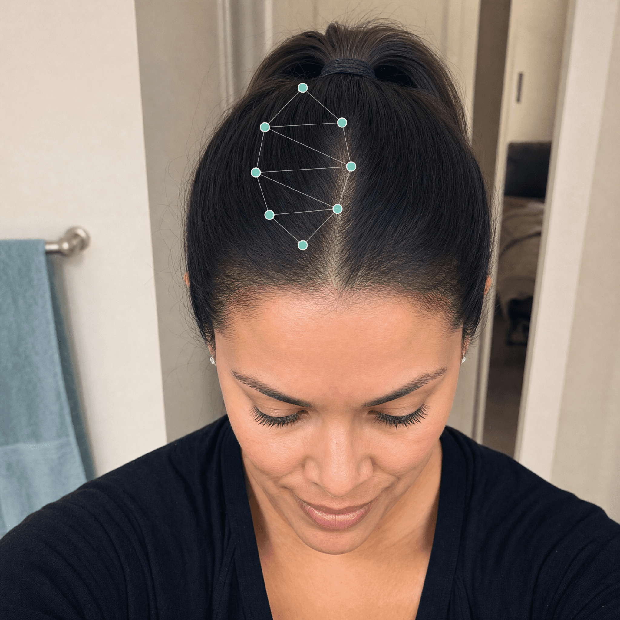 Diana L. after treatment