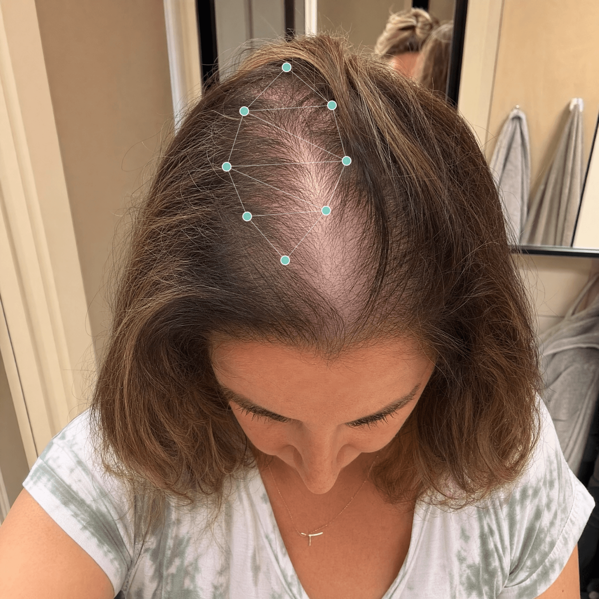 Sarah K. before treatment