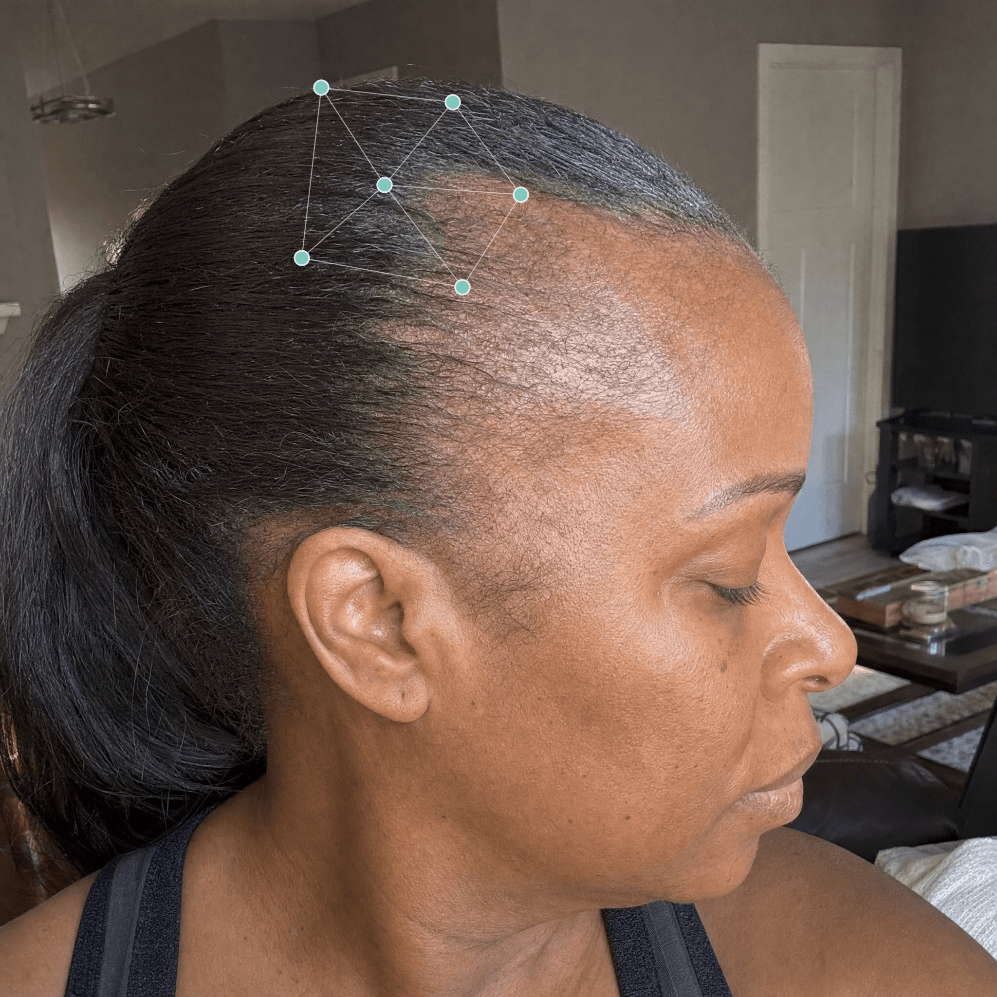 Michelle R. before treatment