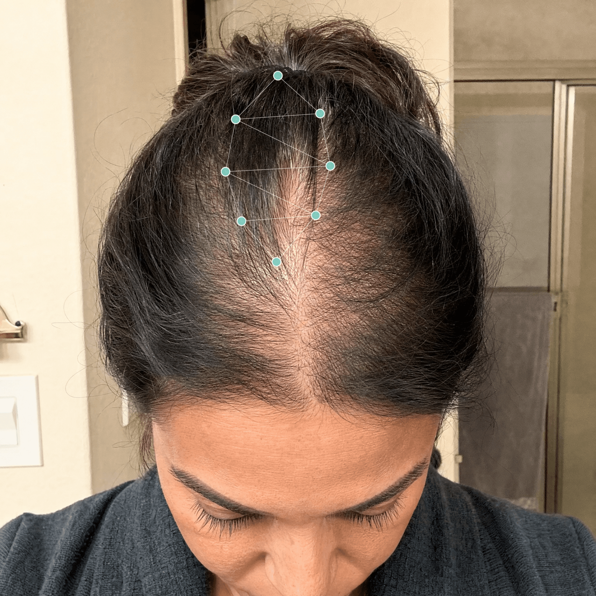 Diana L. before treatment